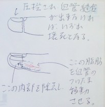私の方法